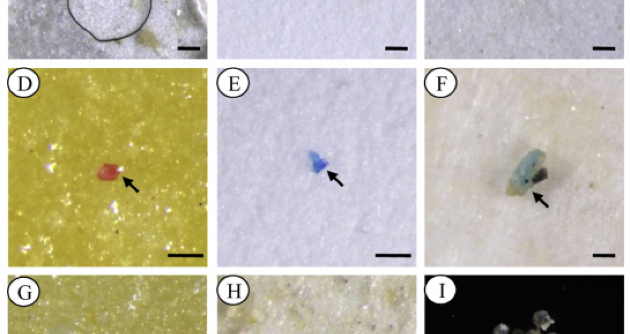  The photographs were taken directly on the filter paper (AeH), and some special microplastics were transferred to a hollow glass slide for photographs (I). The arrows indicate fibers (AeC), fragments (DeF) and pellets (GeI). Scale bar ¼ 100 mm.